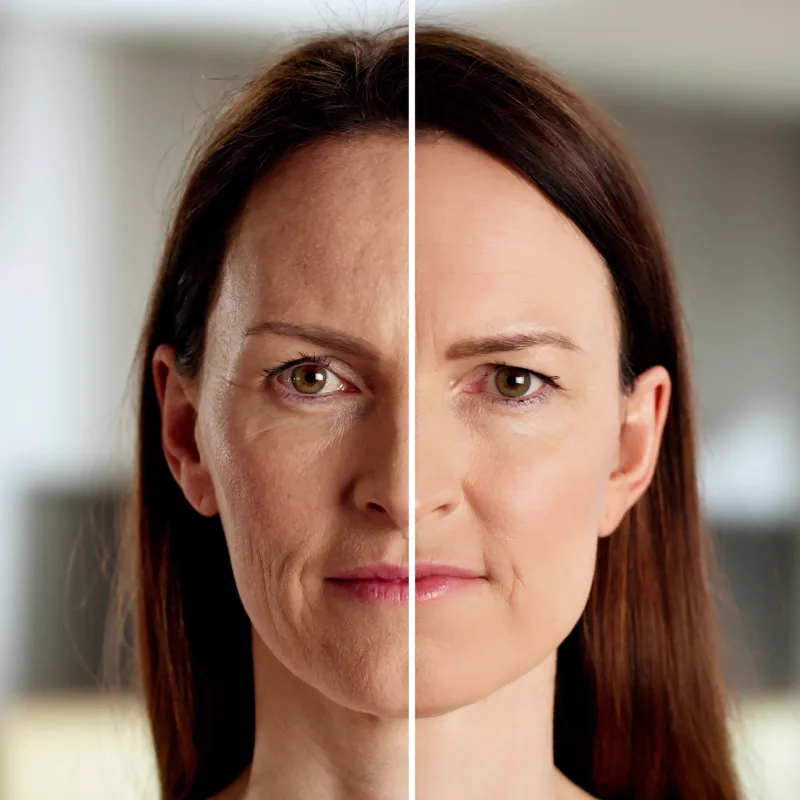 Before and after results at SafiraMD