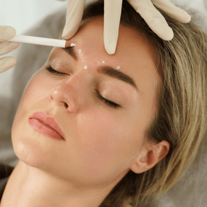 What is Botox — treatment detail at SafiraMD