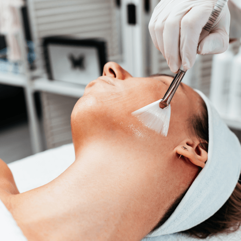 chemical peels details at SafiraMD