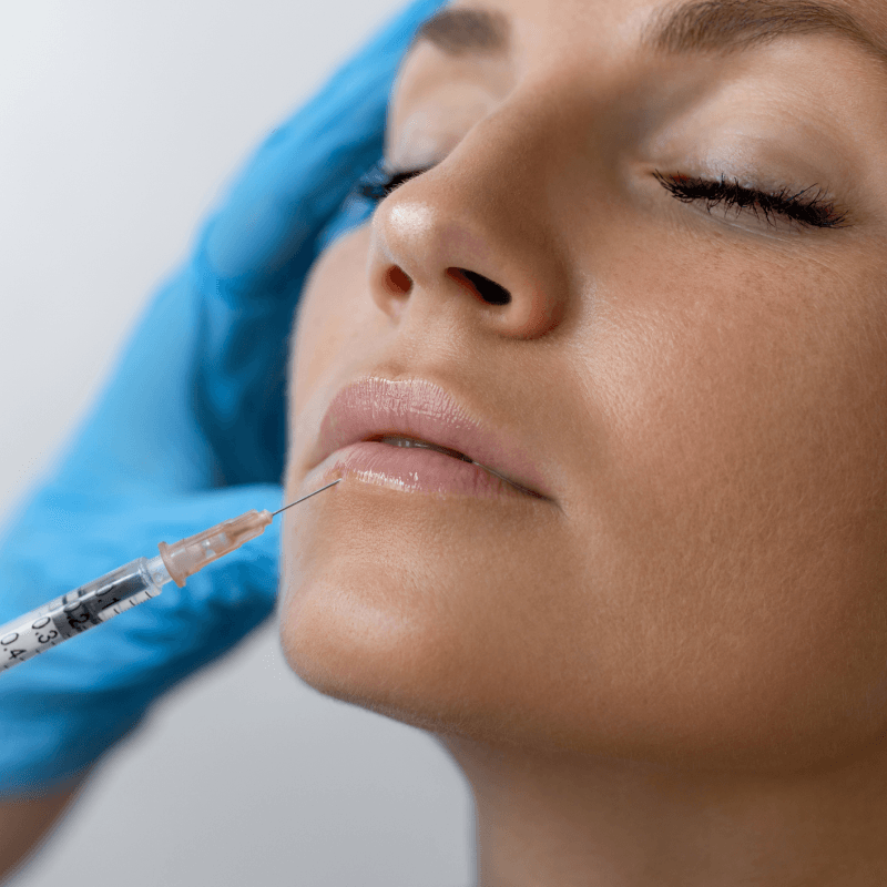 dermal fillers details at SafiraMD
