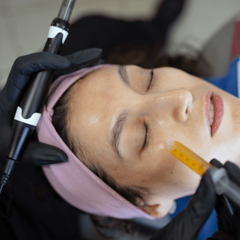 prp therapy details at SafiraMD